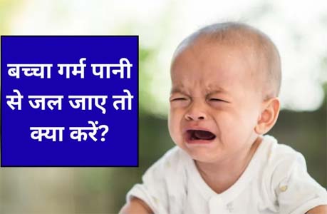 बच्चे पर गर्म पानी गिर जाए तो क्या करें? डॉक्टर ने बताया कैसे मिलेगा आराम, किन गलतियों से करें परहेज