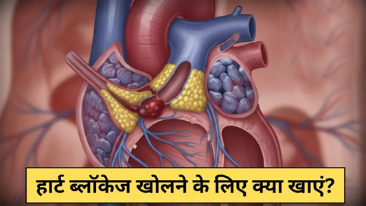 हार्ट की ब्लॉकेज को कैसे साफ करें? यहां जानिए दिल की अवरुद्ध नसों को खोलने के लिए क्या खाना चाहिए